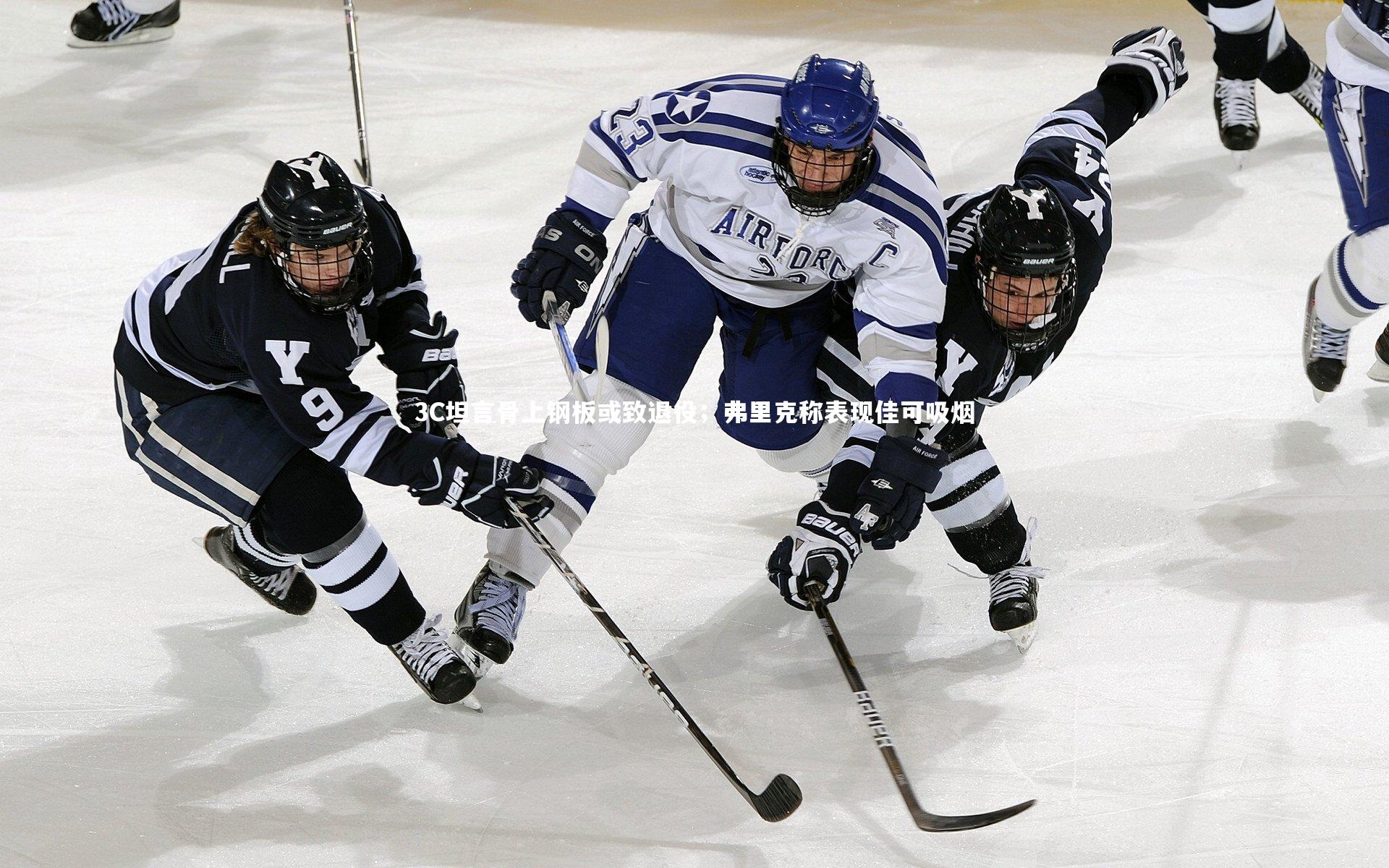 3C坦言骨上钢板或致退役；弗里克称表现佳可吸烟